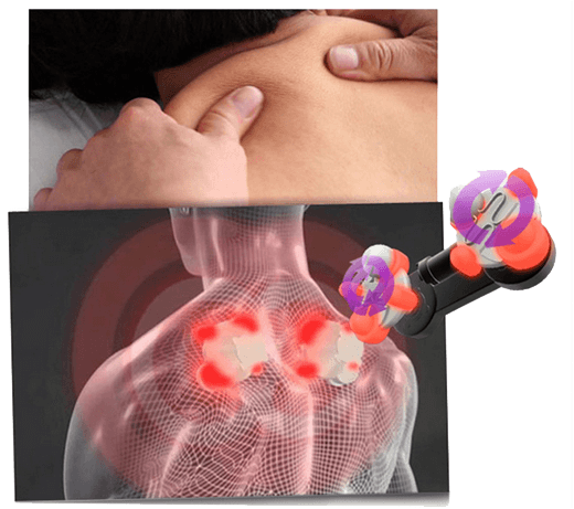 Healax-iShoulder-mechanism